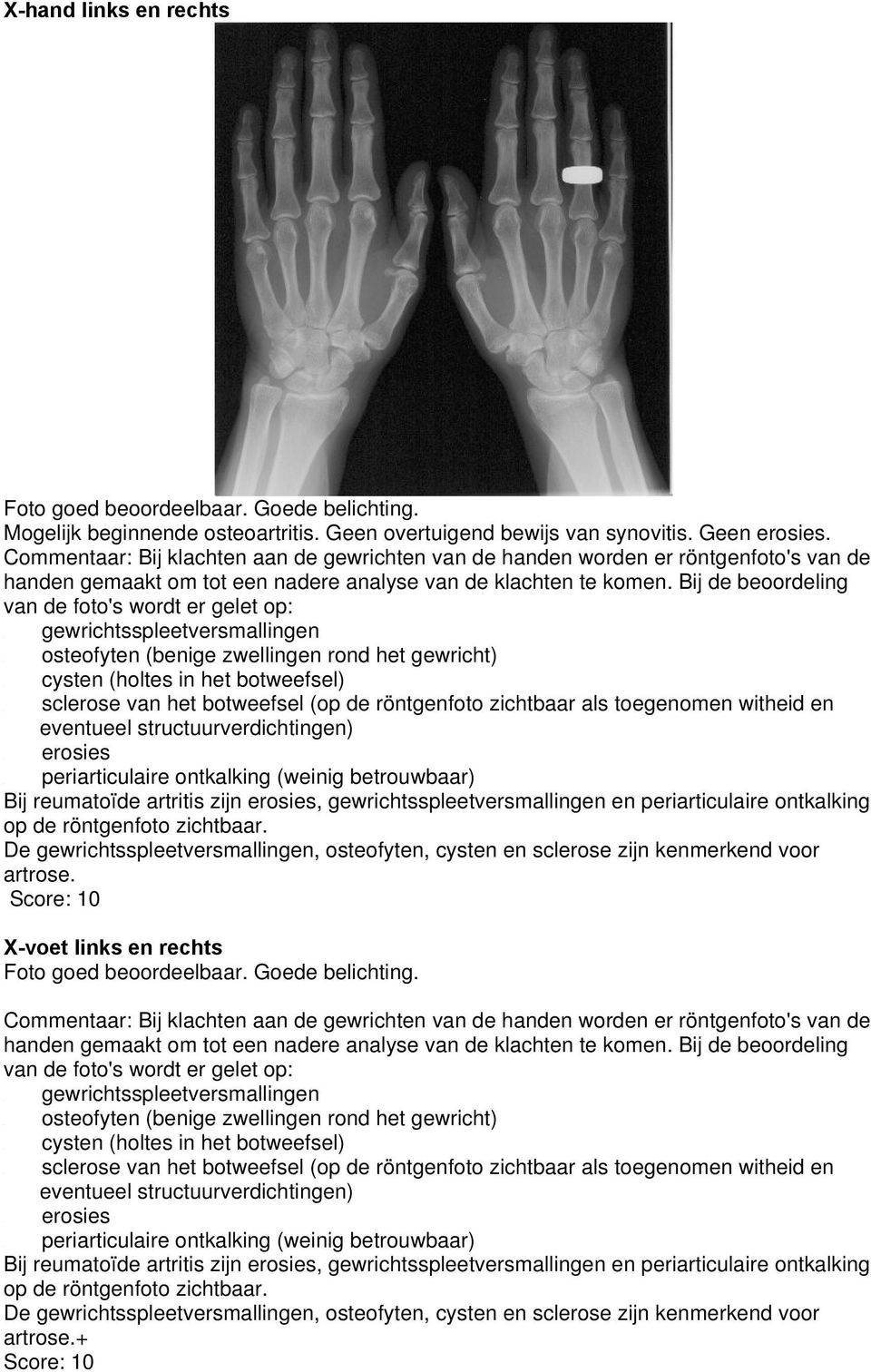 Bij de beoordeling van de foto's wordt er gelet op: gewrichtsspleetversmallingen osteofyten (benige zwellingen rond het gewricht) cysten (holtes in het botweefsel) sclerose van het botweefsel (op de