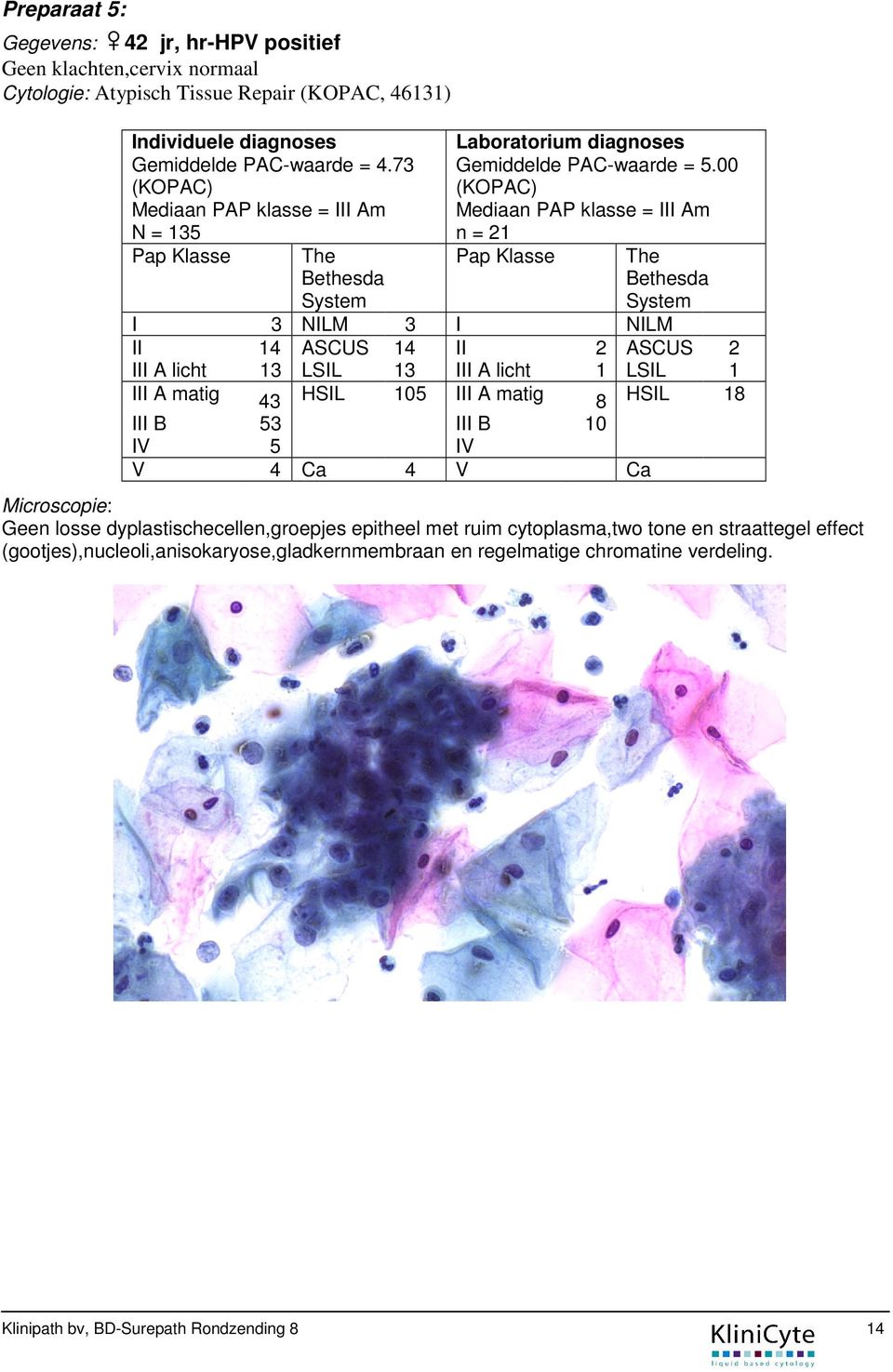 00 (KOPAC) Mediaan PAP klasse = Am n = 21 The Bethesda System NLM 2 ASCUS 2 A licht 1 LSL 1 A matig 18 8 HSL B B 53 5 4 Ca 4 10 Ca Microscopie: Geen losse dyplastischecellen,groepjes