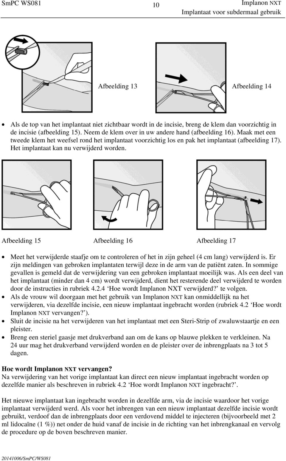 Het implantaat kan nu verwijderd worden. Afbeelding 15 Afbeelding 16 Afbeelding 17 Meet het verwijderde staafje om te controleren of het in zijn geheel (4 cm lang) verwijderd is.