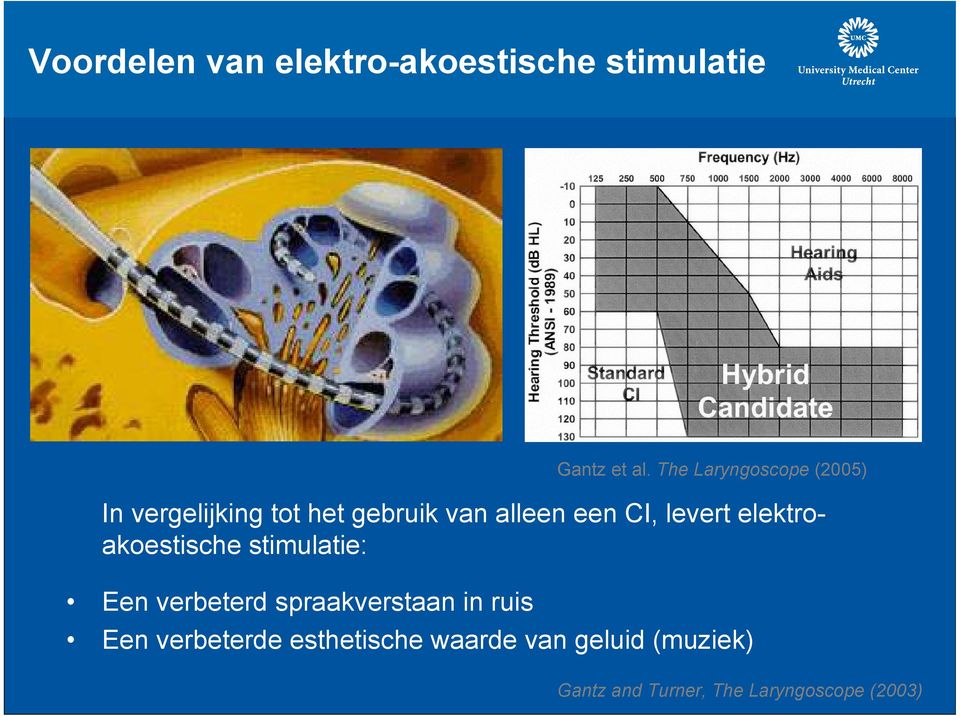 verbeterd spraakverstaan in ruis Gantz et al.