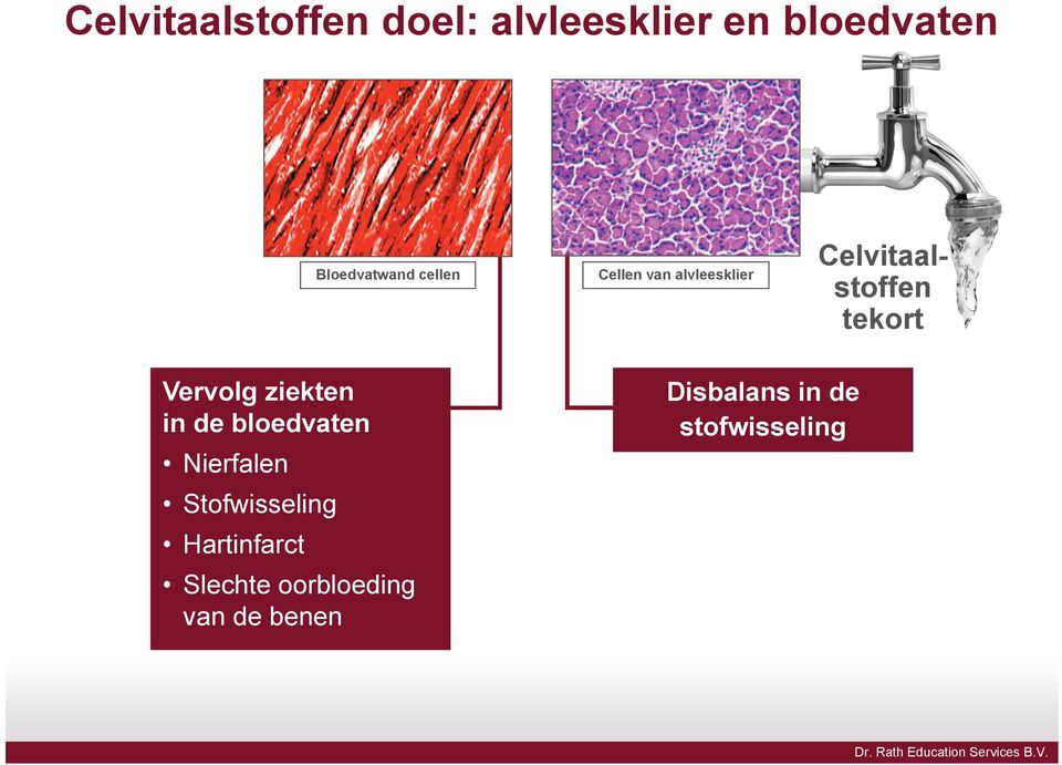 ziekten in de bloedvaten Nierfalen Stofwisseling Hartinfarct