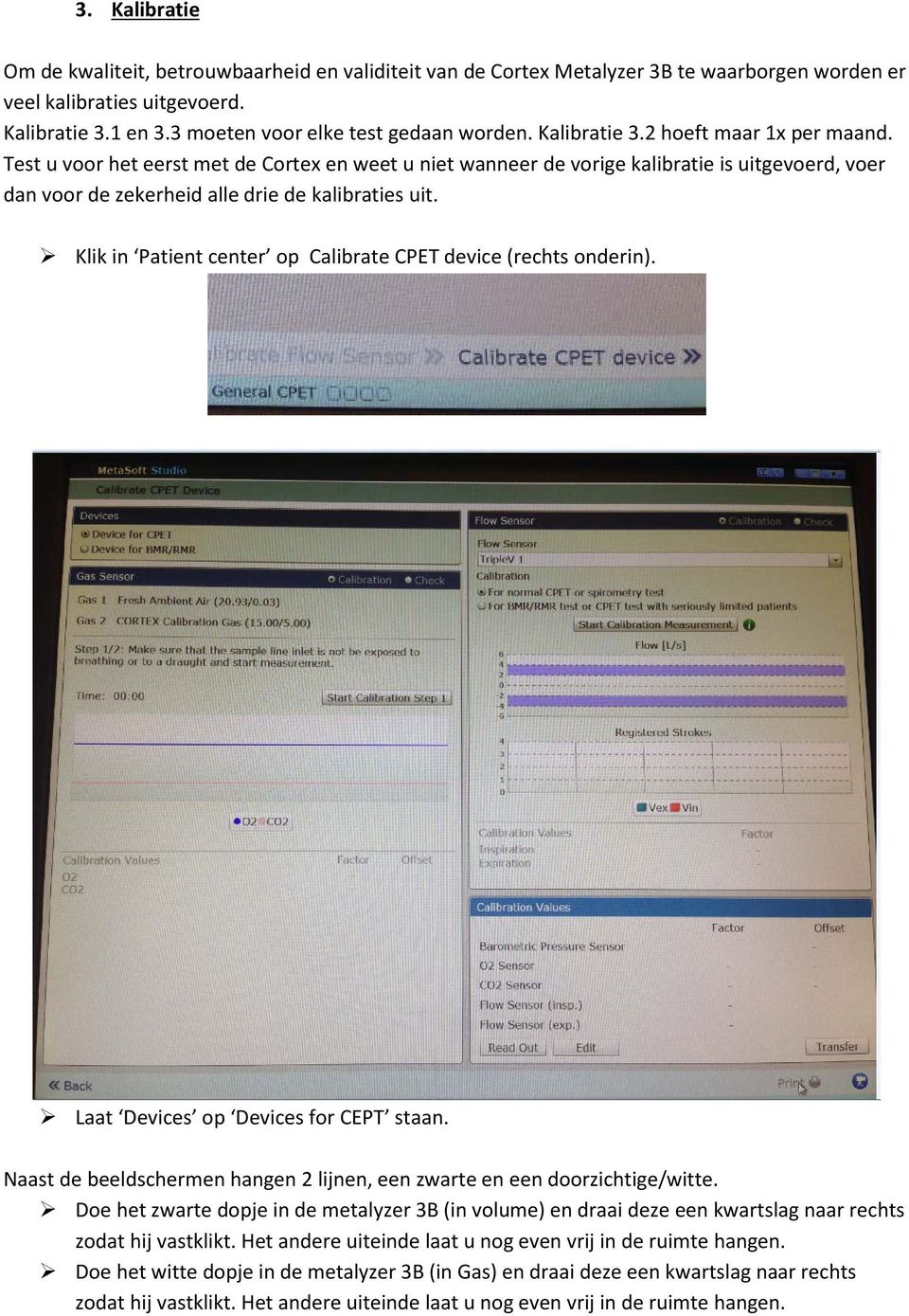 Klik in Patient center op Calibrate CPET device (rechts onderin). Laat Devices op Devices for CEPT staan. Naast de beeldschermen hangen 2 lijnen, een zwarte en een doorzichtige/witte.