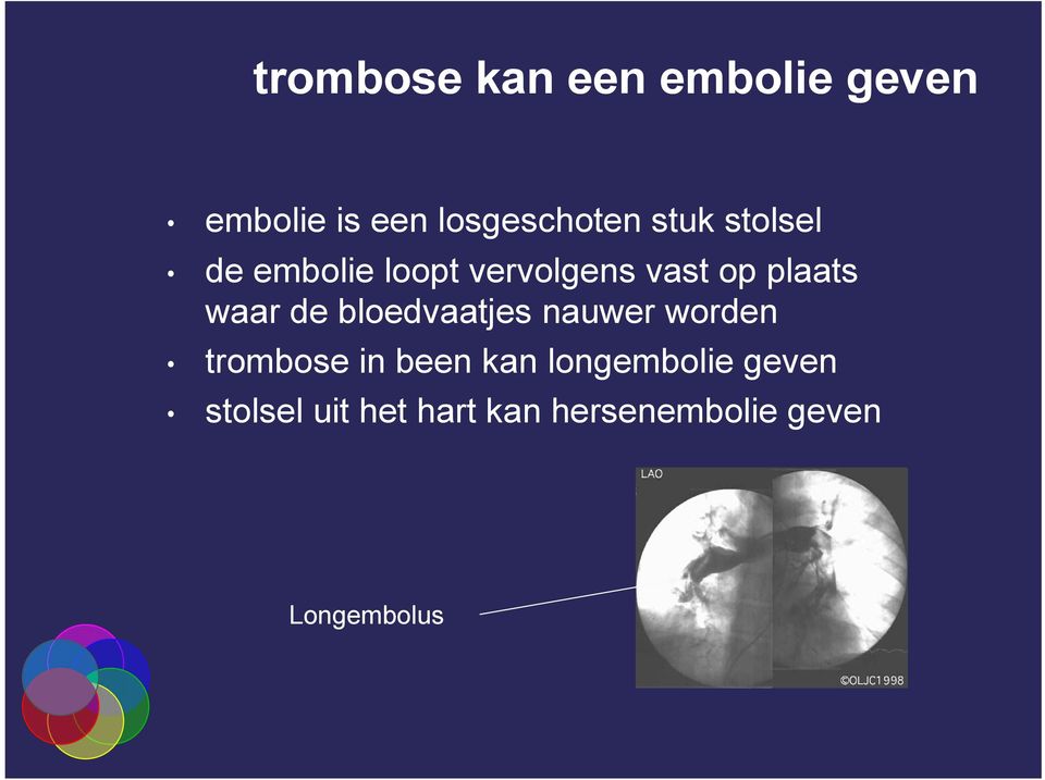 de bloedvaatjes nauwer worden trombose in been kan