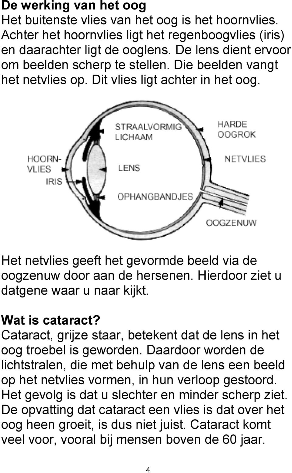 Hierdoor ziet u datgene waar u naar kijkt. Wat is cataract? Cataract, grijze staar, betekent dat de lens in het oog troebel is geworden.