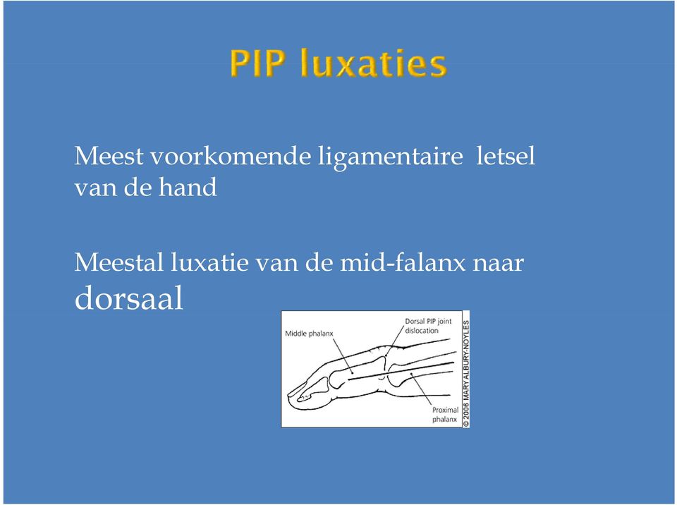 de hand Meestal lluxatie