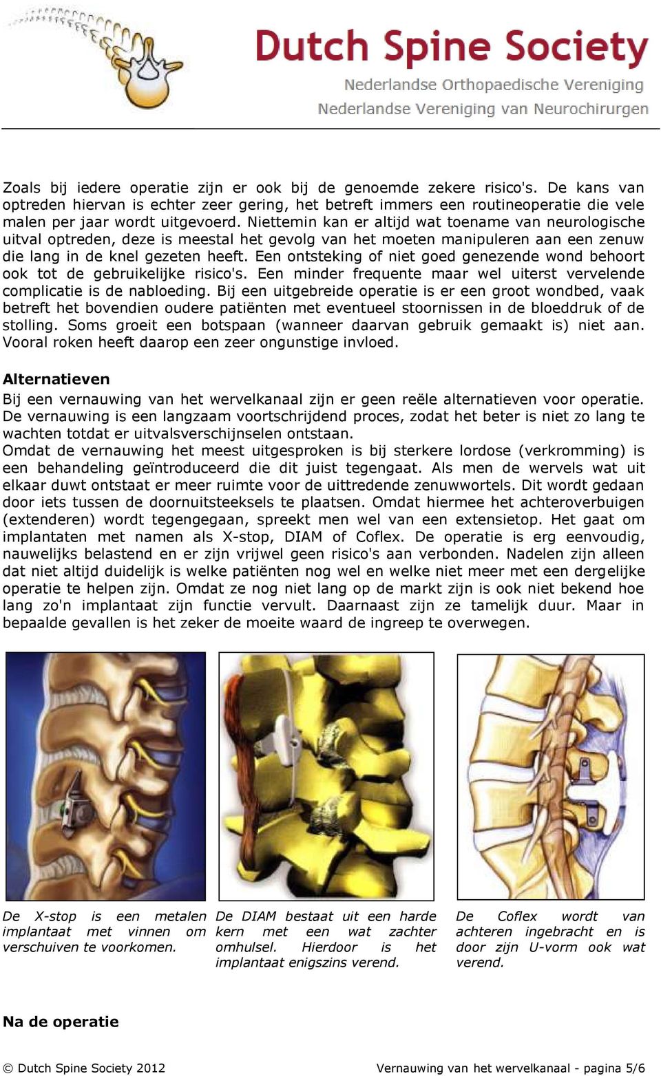 Niettemin kan er altijd wat toename van neurologische uitval optreden, deze is meestal het gevolg van het moeten manipuleren aan een zenuw die lang in de knel gezeten heeft.