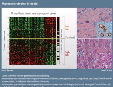 Adjuvant Pte 60 jaar, via BOB mammacarcinoom vastgesteld Mammasparende therapie PA: pt2n1, graad 3, ER/PR+, Her2- MDO: nabehandeling?