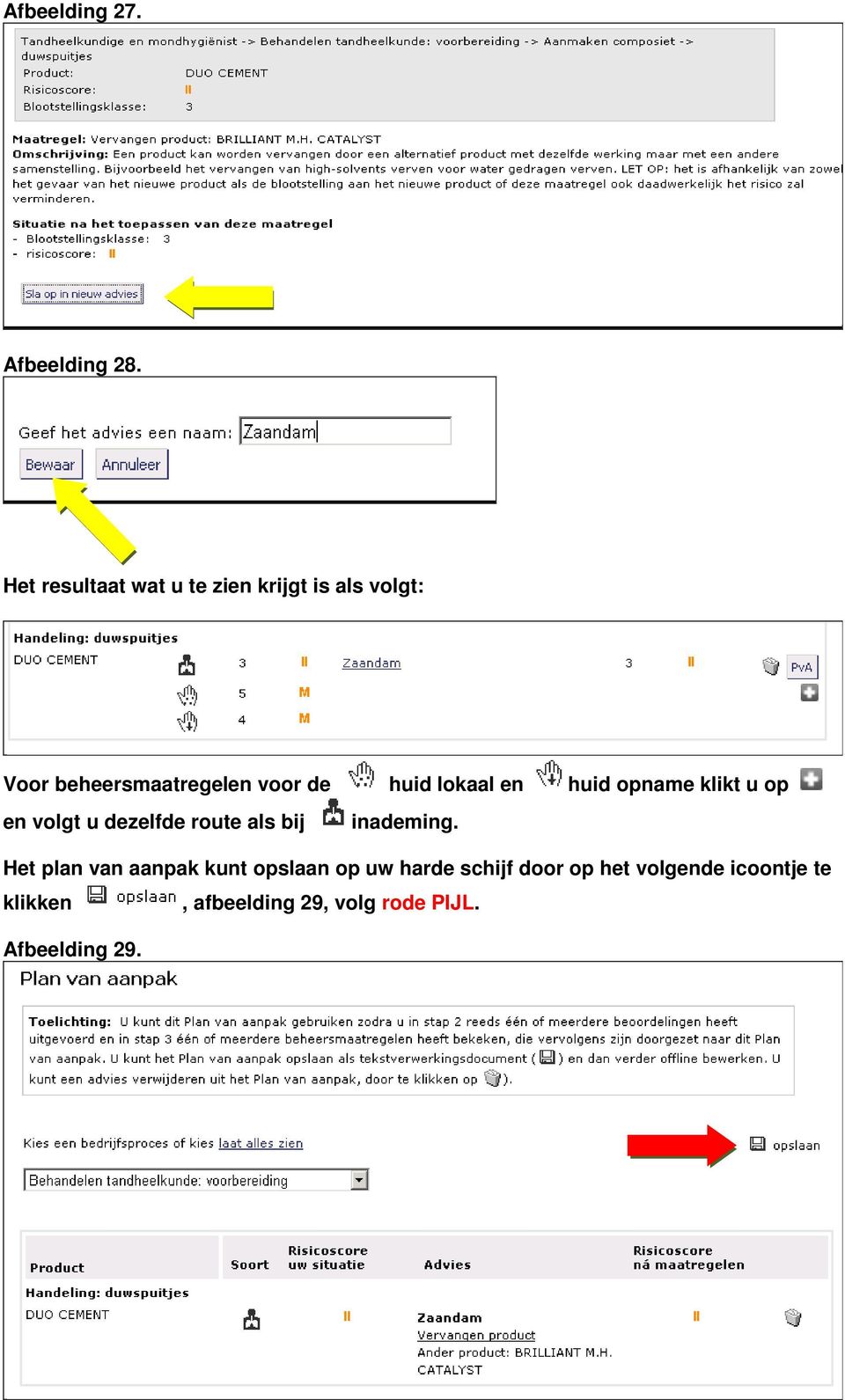 huid lokaal en huid opname klikt u op en volgt u dezelfde route als bij inademing.