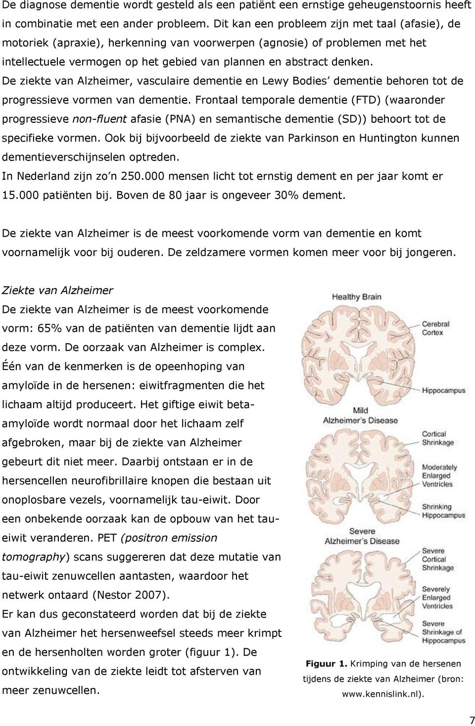 De ziekte van Alzheimer, vasculaire dementie en Lewy Bodies dementie behoren tot de progressieve vormen van dementie.