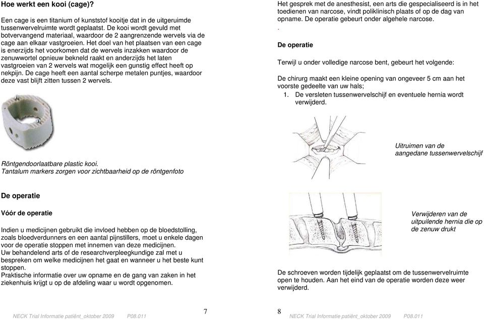 Het doel van het plaatsen van een cage is enerzijds het voorkomen dat de wervels inzakken waardoor de zenuwwortel opnieuw bekneld raakt en anderzijds het laten vastgroeien van 2 wervels wat mogelijk