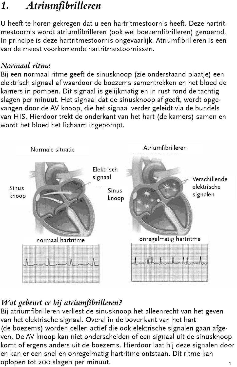 Normaal ritme Bij een normaal ritme geeft de sinusknoop (zie onderstaand plaatje) een elektrisch signaal af waardoor de boezems samentrekken en het bloed de kamers in pompen.