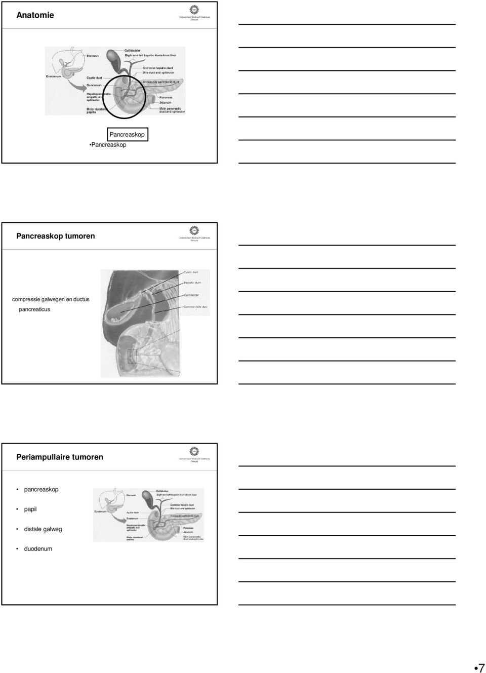 en ductus pancreaticus Periampullaire