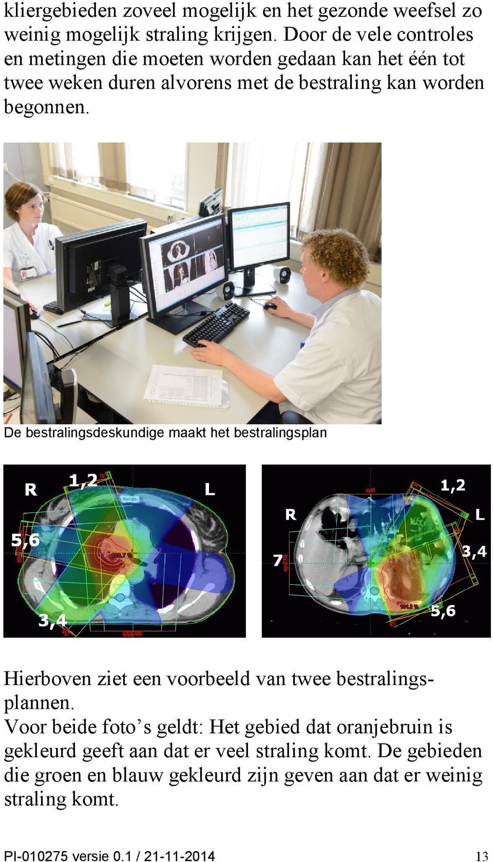 De bestralingsdeskundige maakt het bestralingsplan Hierboven ziet een voorbeeld van twee bestralingsplannen.