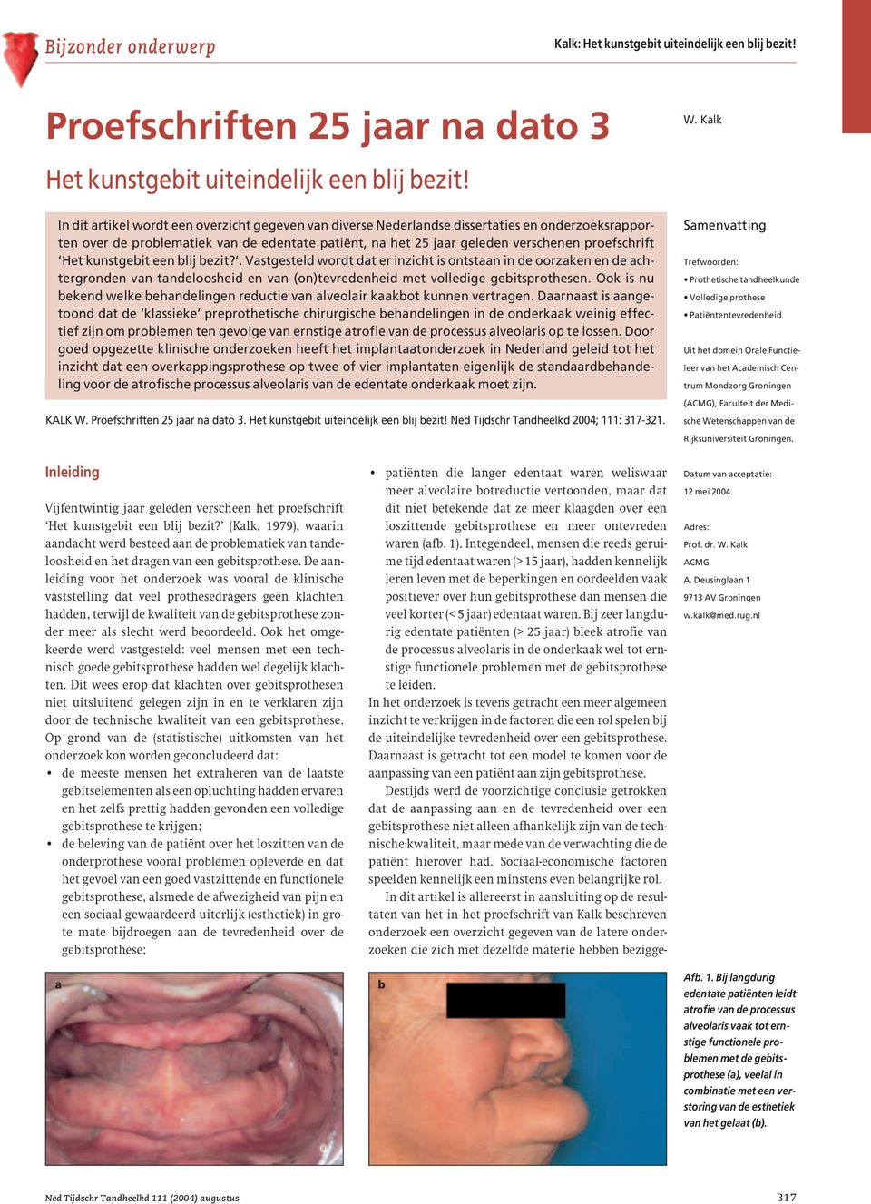 kunstgebit een blij bezit?. Vastgesteld wordt dat er inzicht is ontstaan in de oorzaken en de achtergronden van tandeloosheid en van (on)tevredenheid met volledige gebitsprothesen.