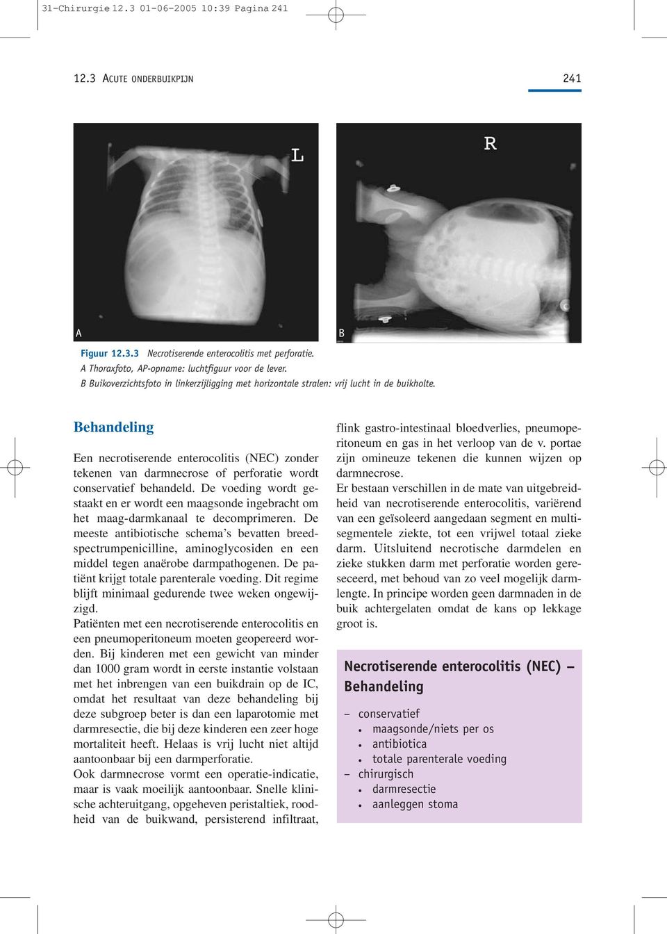 Behandeling Een necrotiserende enterocolitis (NEC) zonder tekenen van darmnecrose of perforatie wordt conservatief behandeld.