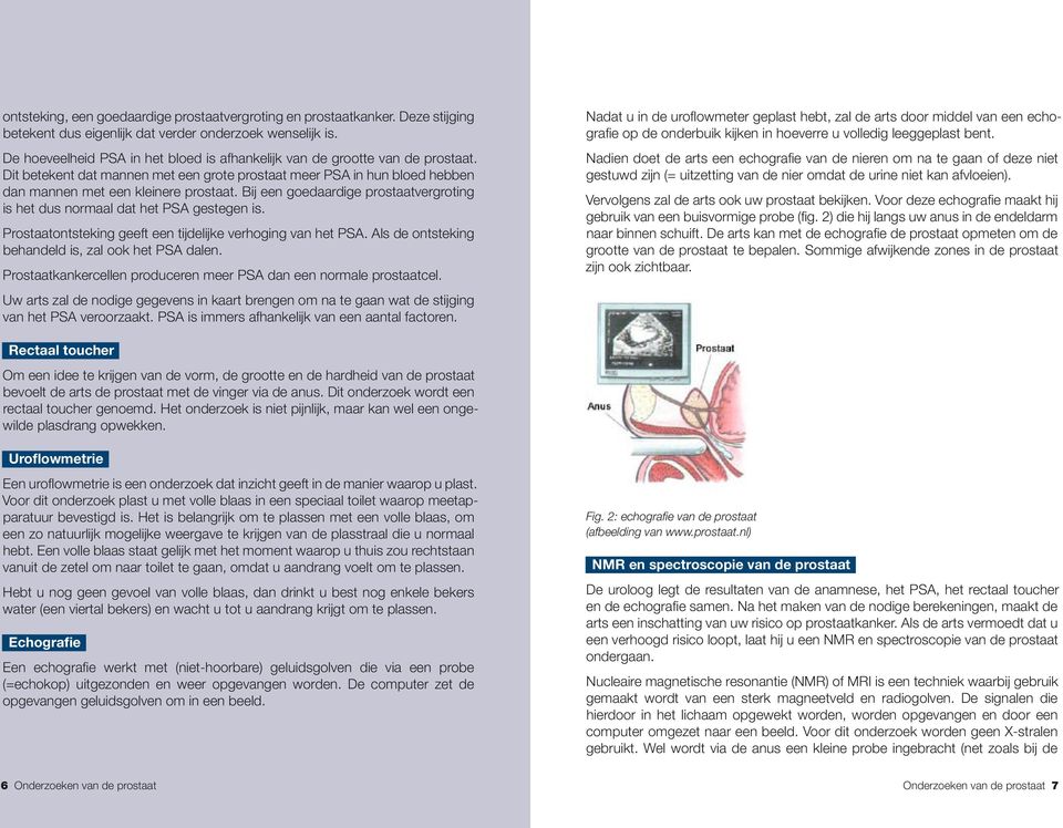 Bij een goedaardige prostaatvergroting is het dus normaal dat het PSA gestegen is. Prostaatontsteking geeft een tijdelijke verhoging van het PSA. Als de ontsteking behandeld is, zal ook het PSA dalen.