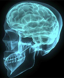 Onder hoorn- en vioolspelers komt de ongemakkelijke aandoening Torticollis spasmodica voor.