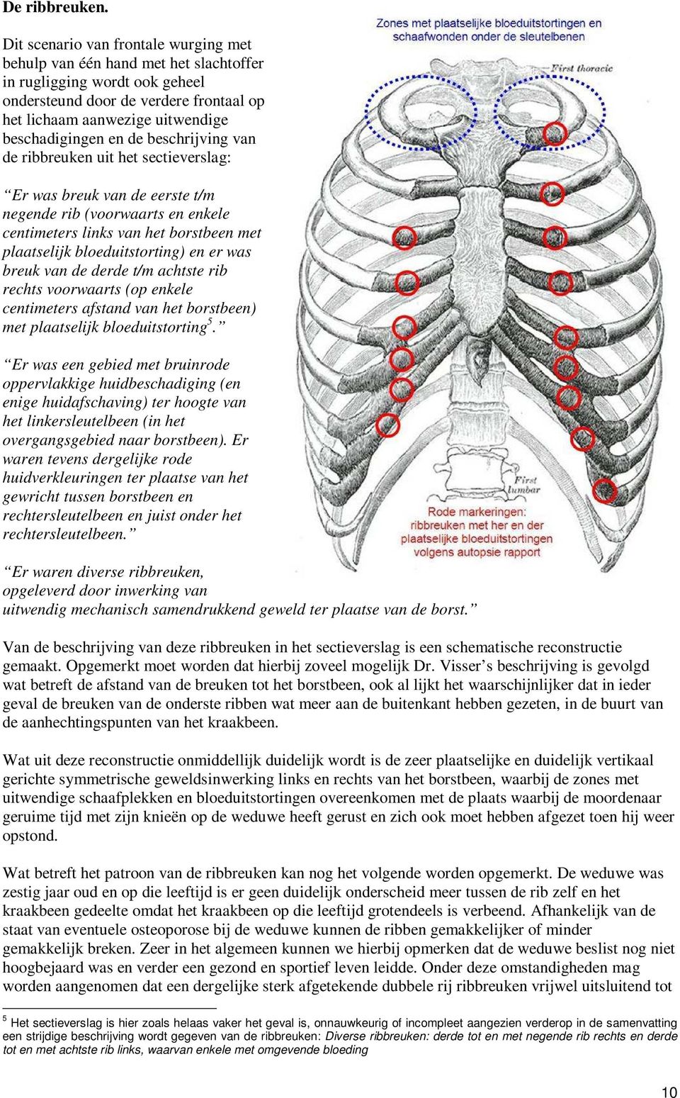 de beschrijving van de ribbreuken uit het sectieverslag: Er was breuk van de eerste t/m negende rib (voorwaarts en enkele centimeters links van het borstbeen met plaatselijk bloeduitstorting) en er