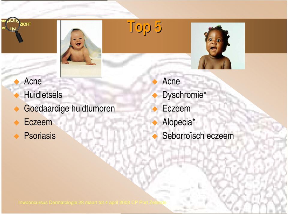 Eczeem Psoriasis Acne