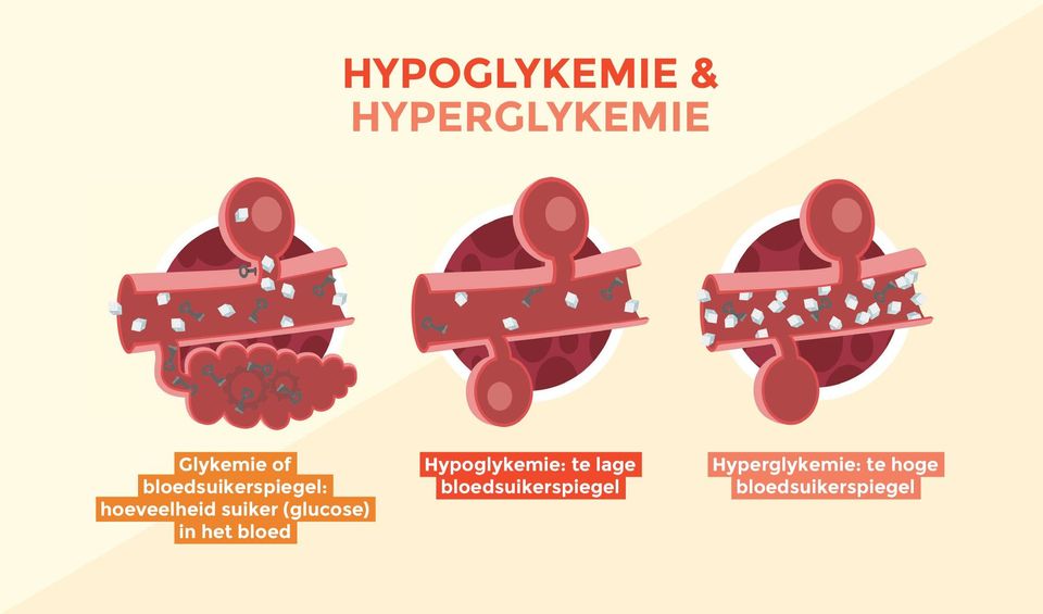 (glucose) in het bloed Hypoglykemie: te lage