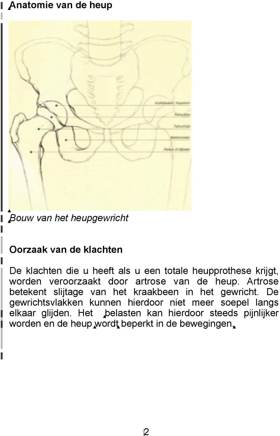 Artrose betekent slijtage van het kraakbeen in het gewricht.