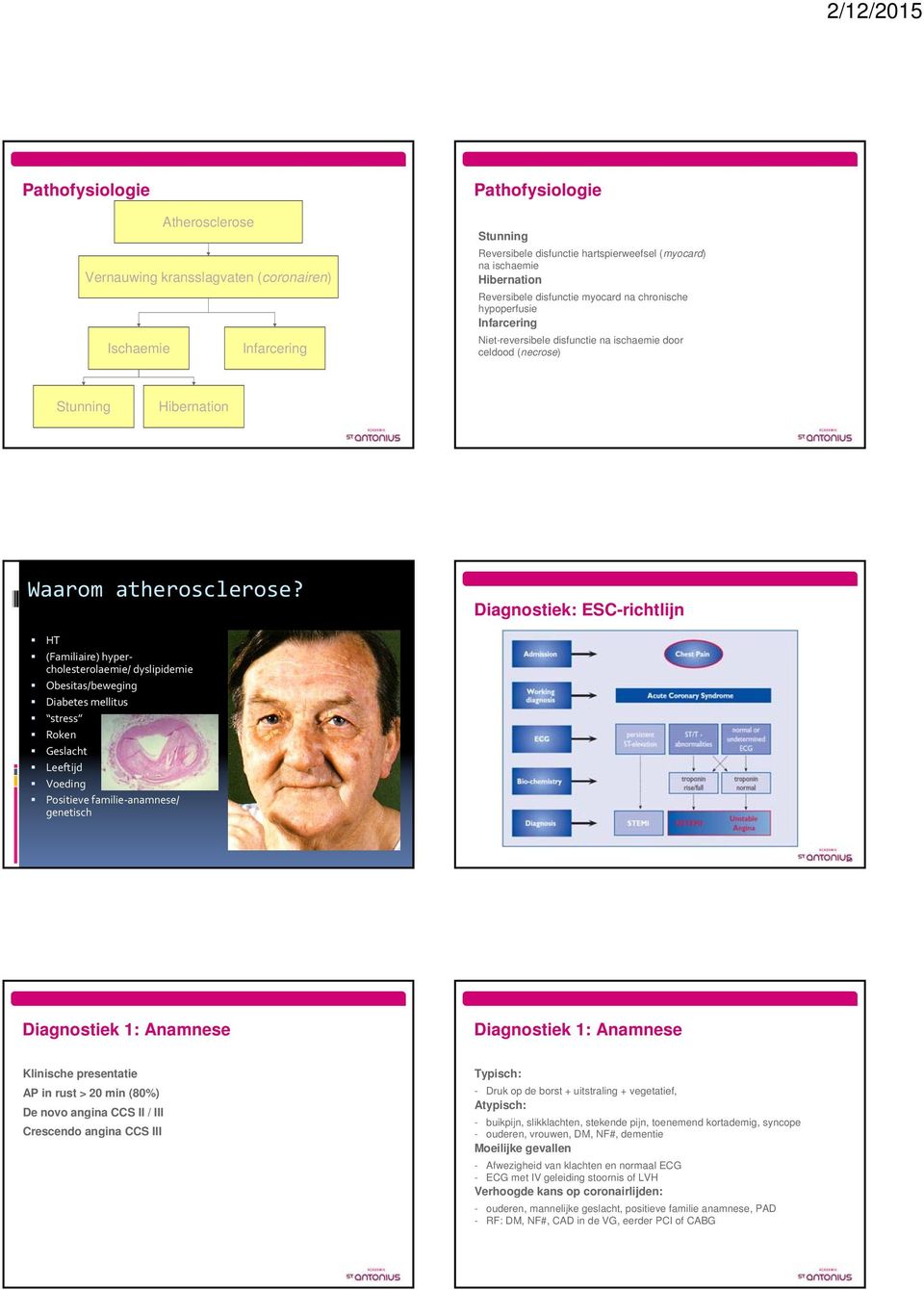 Diagnostiek: ESC-richtlijn HT (Familiaire) hypercholesterolaemie/ dyslipidemie Obesitas/beweging Diabetes mellitus stress Roken Geslacht Leeftijd Voeding Positieve familie anamnese/ genetisch 10