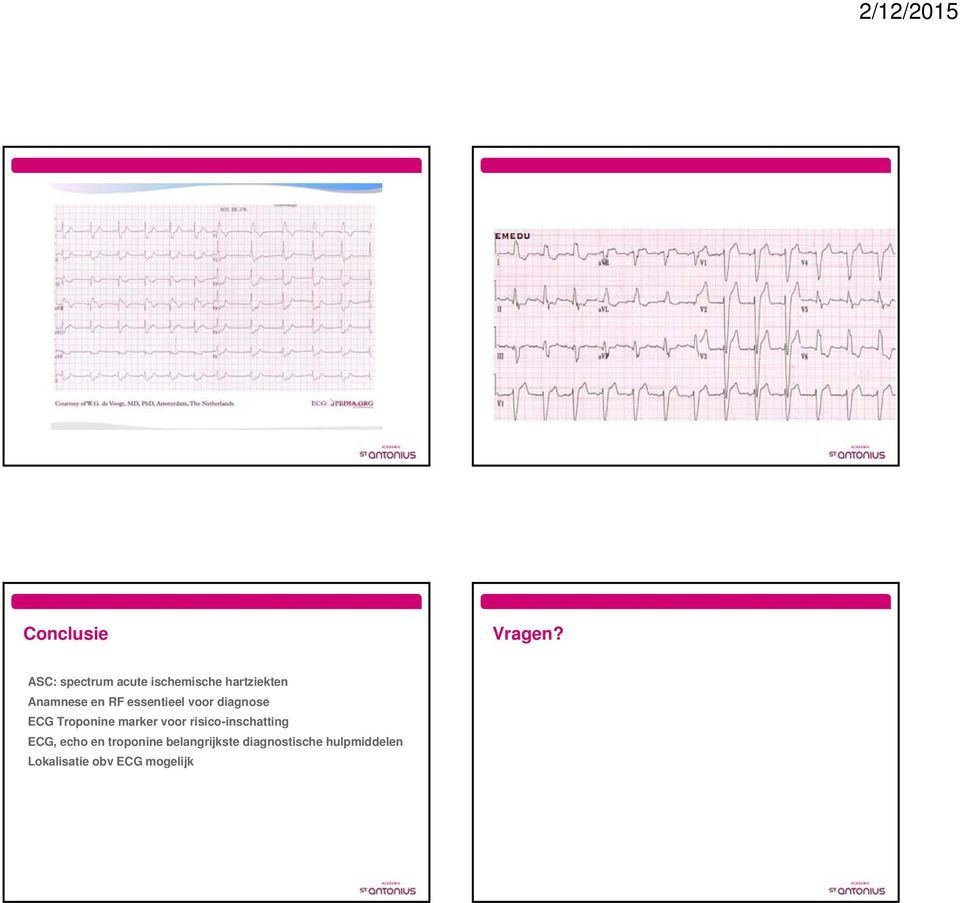 essentieel voor diagnose ECG Troponine marker voor