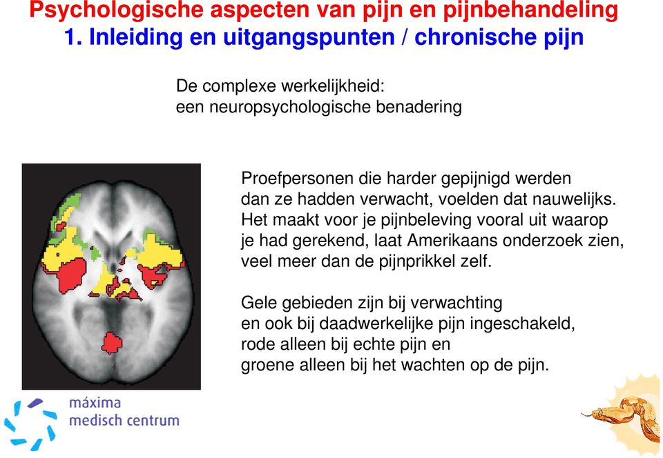 Het maakt voor je pijnbeleving vooral uit waarop je had gerekend, laat Amerikaans onderzoek zien, veel meer dan de