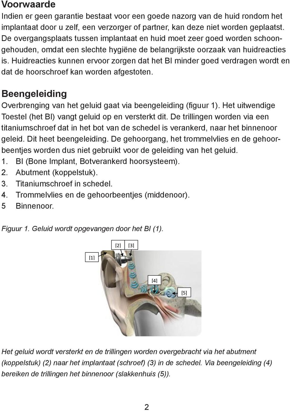 Huidreacties kunnen ervoor zorgen dat het BI minder goed verdragen wordt en dat de hoorschroef kan worden afgestoten. Beengeleiding Overbrenging van het geluid gaat via beengeleiding (figuur 1).