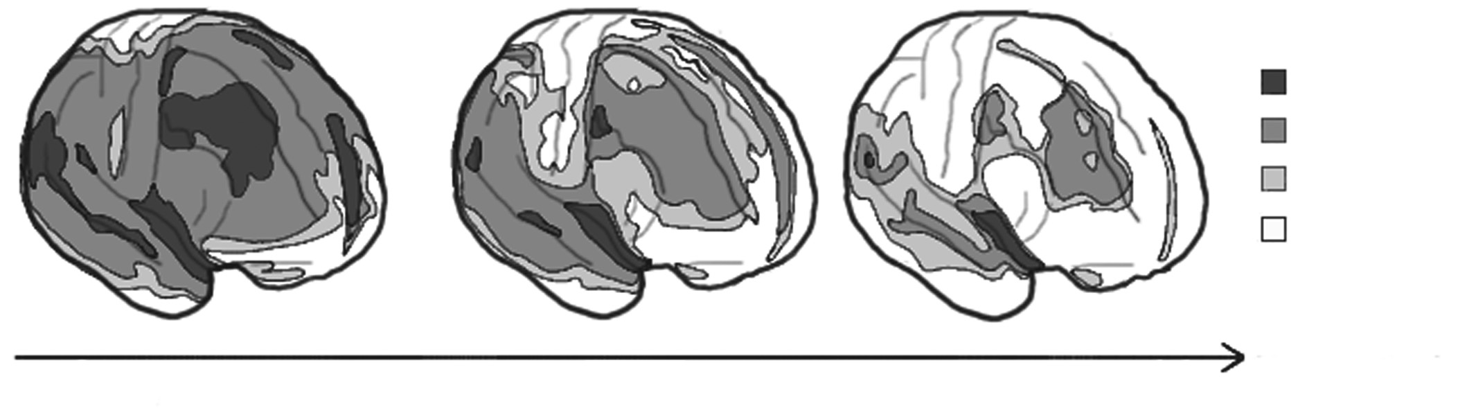 (Sowell et al., 1999, in Dumontheil et al., 2008). O Donnell et al. bestudeerde de corticale dikte zowel in de rostrale PFC als in de dorsolaterale PFC bij kinderen en adolescenten.
