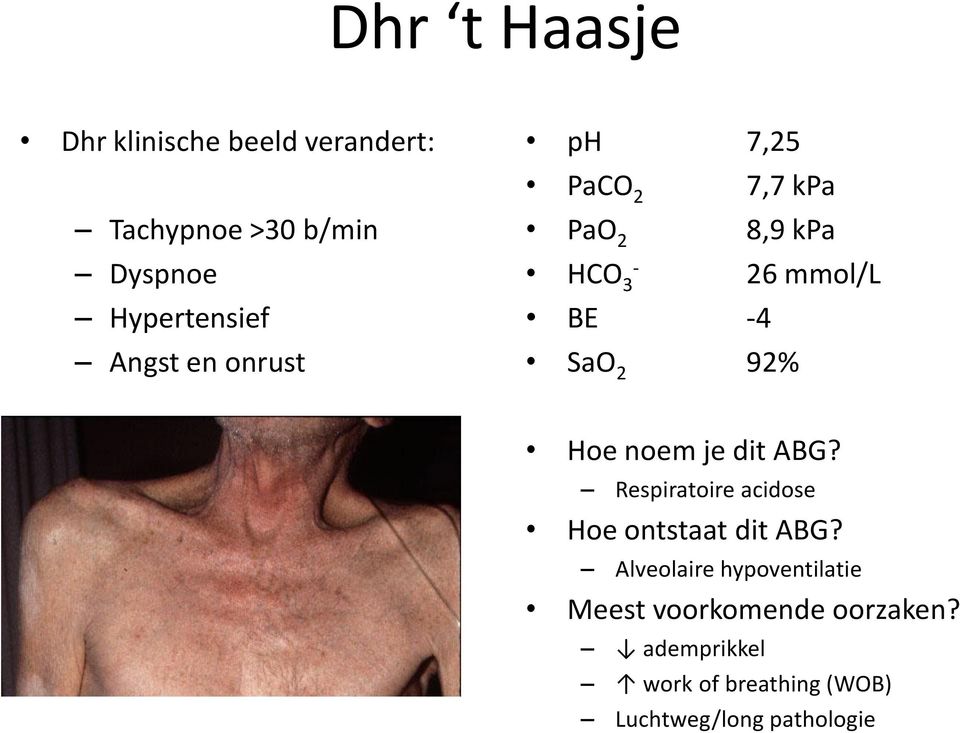 Hoe noem je dit ABG? Respiratoire acidose Hoe ontstaat dit ABG?