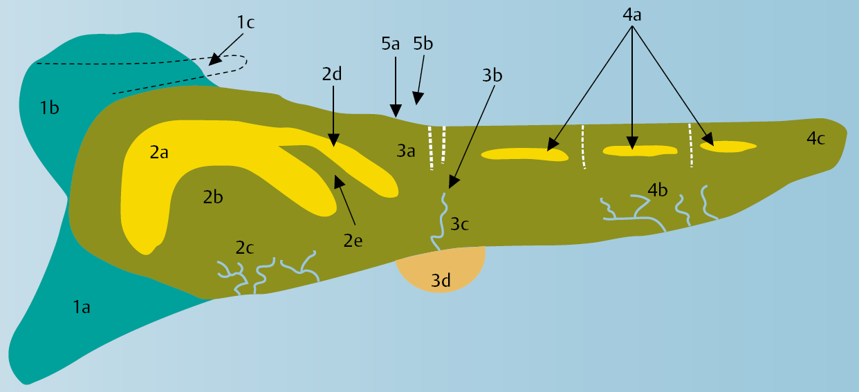 2 Het modeleiland, waarin weergegeven de belangrijkste oorspronkelijk aanwezige milieus: 1: Eilandkop, met 1a: backbarrier plaat; 1b: buitendeltaplaat; 1c: buitendeltageul; 2: