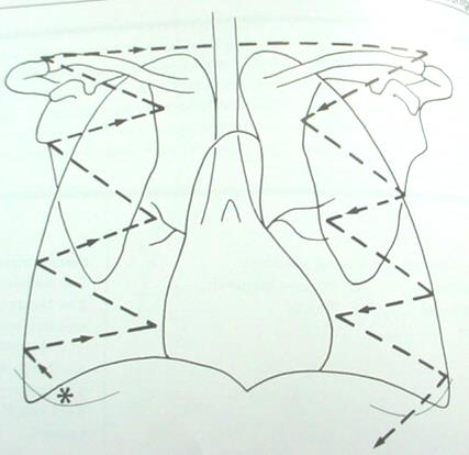 De thoraxfoto Systematiek Systematische benadering Kennis van de normale