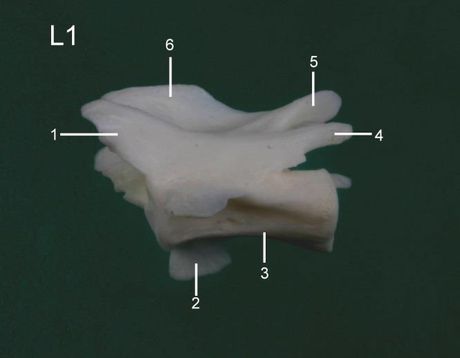 Fig. 14: Schuin lateraal aanzicht van T13 (links): 1=processus accessorius; 2=crista ventralis; 3=processus articularis cranialis; 4=processus spinosus; 5=processus articularis caudalis Schuin