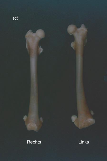 Fig. 33: (a) Vergelijking tussen twee femuren van verschillende individuen in deviatie naar mediaal (valgus) bij craniaal aanzicht (b) Vergelijking tussen twee femuren van verschillende individuen in