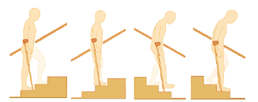 19. Traplopen Bij het oplopen van de trap zet u altijd uw niet-geopereerde been eerst op de volgende trede, gevolgd door uw geopereerde been samen met de kruk.