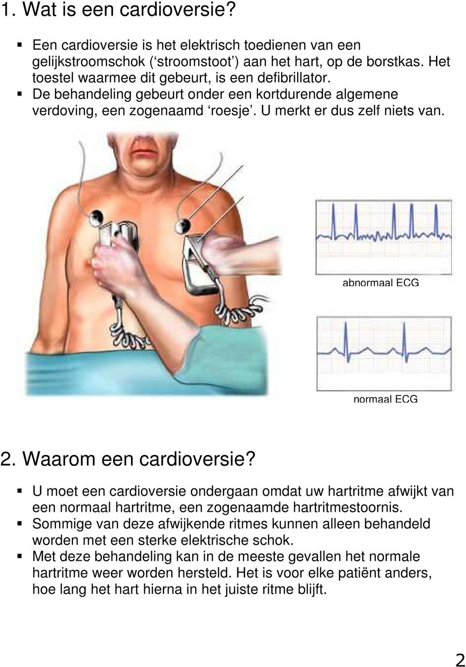 abnormaal ECG normaal ECG 2. Waarom een cardioversie? U moet een cardioversie ondergaan omdat uw hartritme afwijkt van een normaal hartritme, een zogenaamde hartritmestoornis.