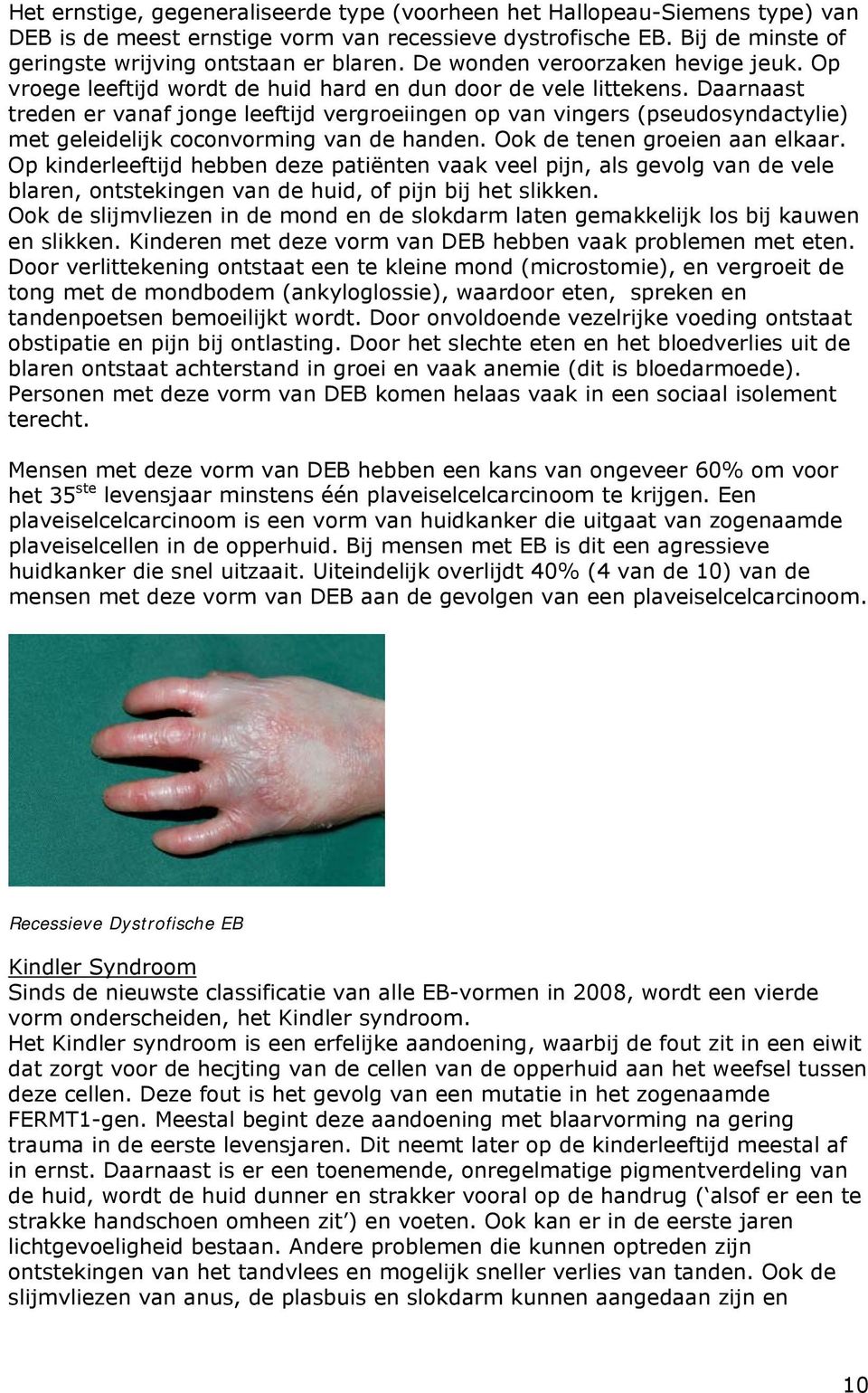 Daarnaast treden er vanaf jonge leeftijd vergroeiingen op van vingers (pseudosyndactylie) met geleidelijk coconvorming van de handen. Ook de tenen groeien aan elkaar.