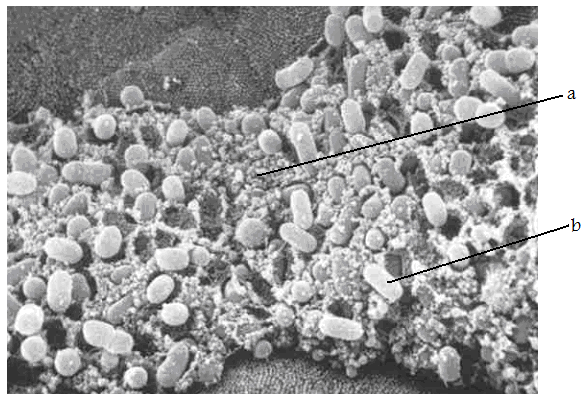 Figuur 1: Adhesie van bacteriën(b) aan het epitheel(a) van de dunne darm 6 dagen na inoculatie van een gespeend big met E. coli O139:K12:H1 (naar Bertschinger en Fairbrother, 1999). Ten slotte zijn E.