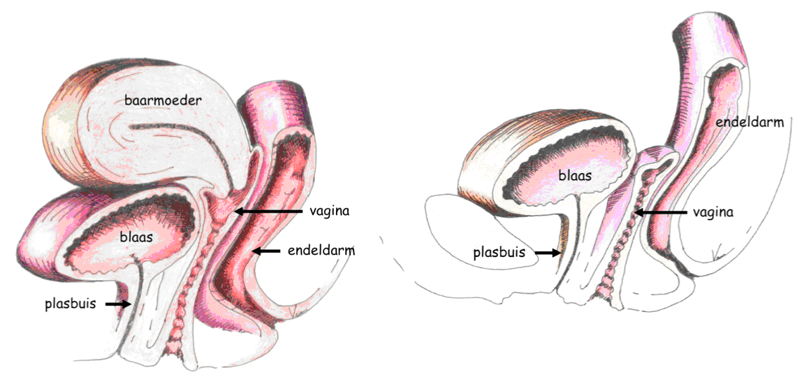 U wordt binnenkort in ons ziekenhuis opgenomen omdat u een vaginale verzakking heeft waarvoor een operatie nodig is. Deze folder geeft uitleg over het ziektebeeld, de operatie en de nazorg.