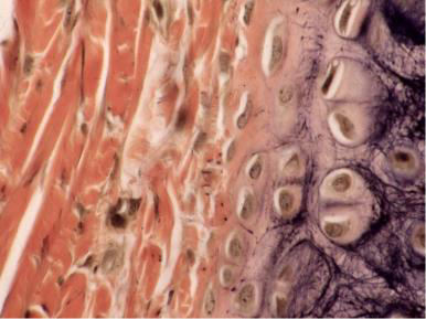 Interstitiële groei: mitotische deling van reeds bestaande chondroblasten en chondrocyten (vooral in embryo) Appositionele groei: cellen vanuit het perichondrium differentiëren tot chondroblasten