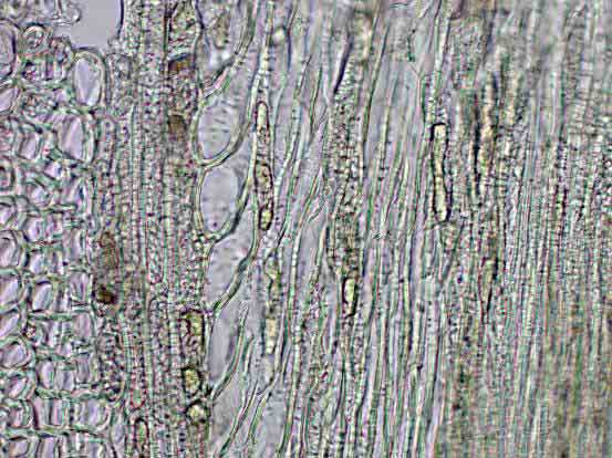 Fig. 9. Acer saccharinum Pyramidale. Xyleem met brede houtstraal (LM-0053). Streepje is 100