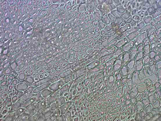 Fig. 85. Gleditsia triacanthos Inermis, oud ontwikkelingsstadium, xyleem in knobbel, lichtmicroscopie. (LM-0016) Streepje is 100µm. Fig. 86.