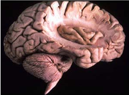 CIC 38 De koopknop in de hersenen Koopgedrag hangt voor een groot deel af van 2 hersengebieden: Het