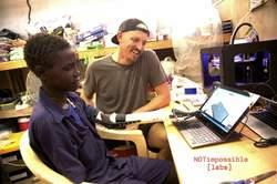 Ugandezen krijgen prothese uit 3d-printer De universiteit van Toronto werkt samen met een Ugandees ziekenhuis om ledenmaten te 3d-printen en slachtoffers zo sneller te helpen.
