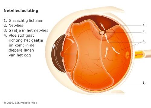 Inleiding De voorkant van het oog wordt gevormd door het hoornvlies. Hierdoor valt het licht naar binnen.