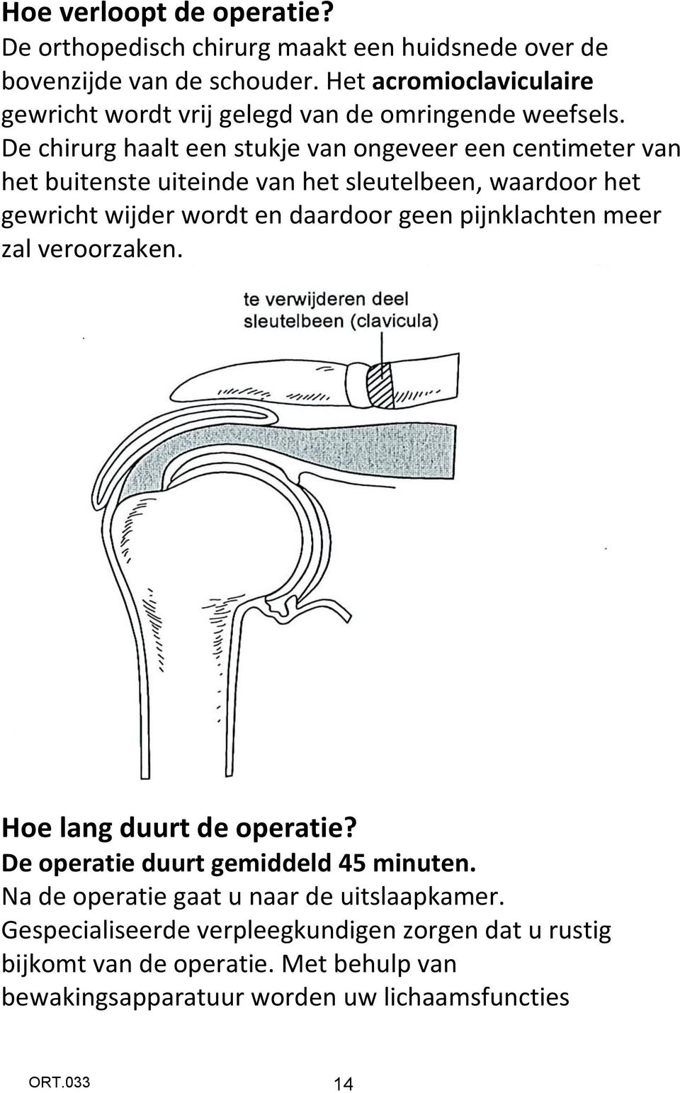 De chirurg haalt een stukje van ongeveer een centimeter van het buitenste uiteinde van het sleutelbeen, waardoor het gewricht wijder wordt en daardoor geen