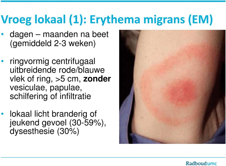 rode/blauwe vlek of ring, >5 cm, zonder vesiculae, papulae,