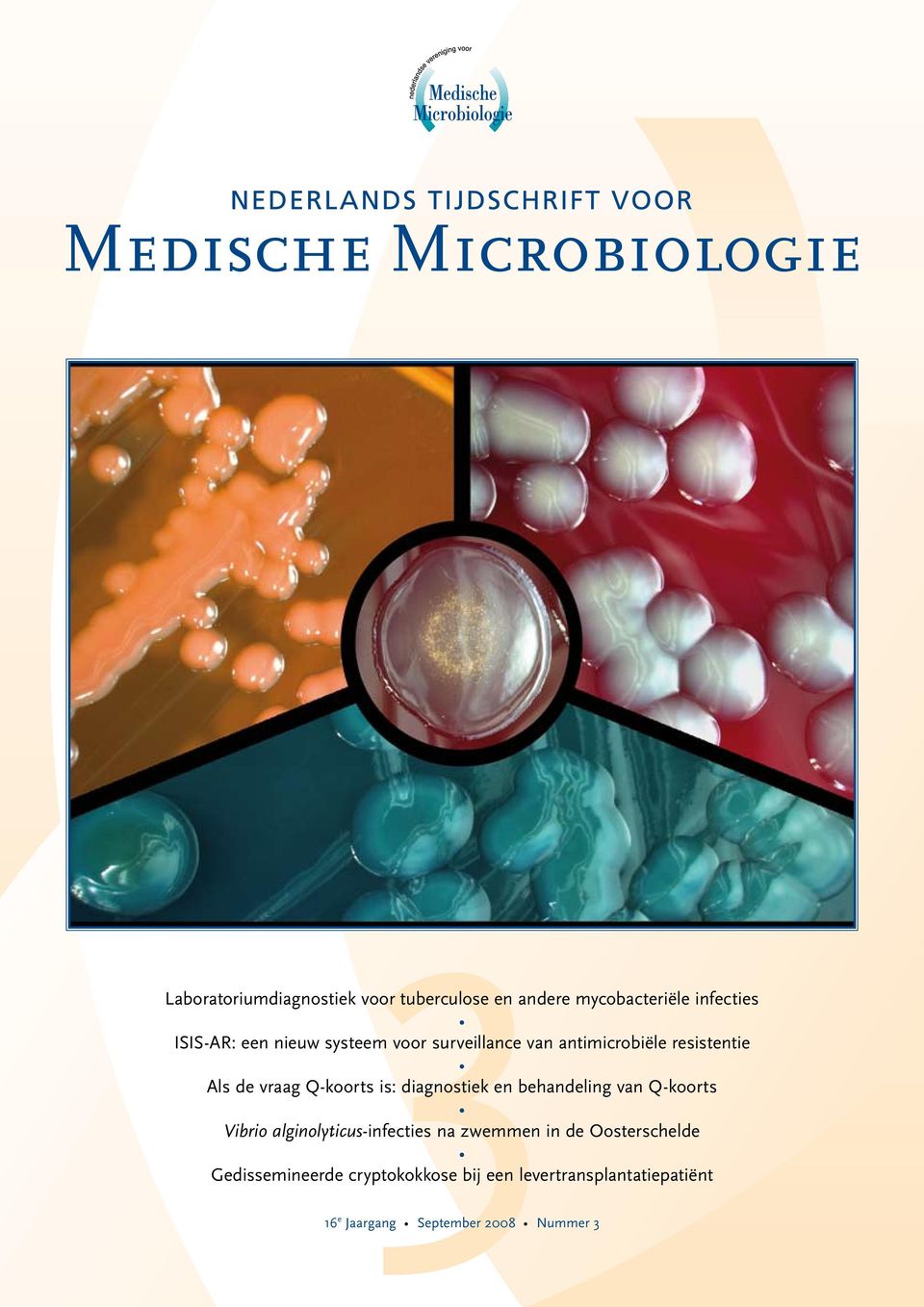 diagnostiek en behandeling van Q-koorts Vibrio alginolyticus-infecties na zwemmen in de