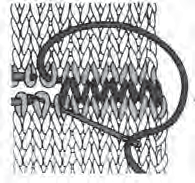 Lorsqu on relève les mailles sur un côté du tricot, du fait qu une maille est plus large que haute, piquer l aiguille dans chaque rang puis, au rg suivant, en tricotant le point indiqué, il faut